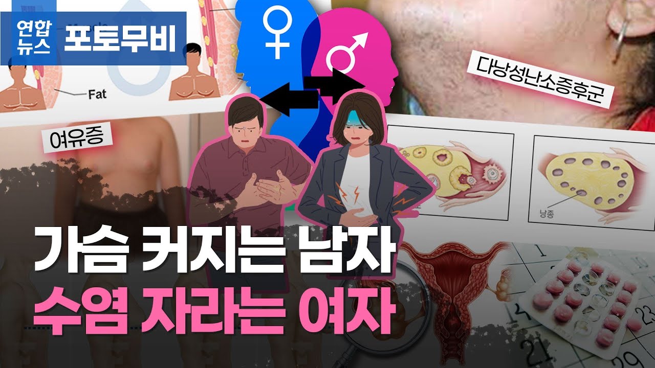 가슴 달린 남자·수염 나는 여자…요즘 부쩍 늘어난 이유는? [포토무비] | 연합뉴스
