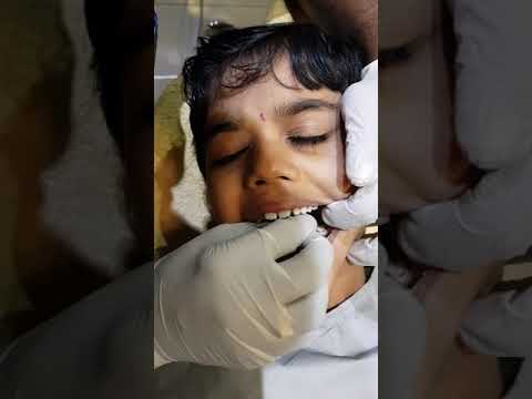 Painfree  dental treatment on a 5 year old kid