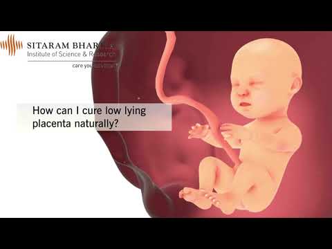 How to Treat Low Lying Placenta Naturally | Dr. Anita Sabherwal Anand